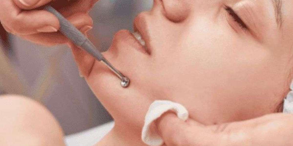 Article Picture