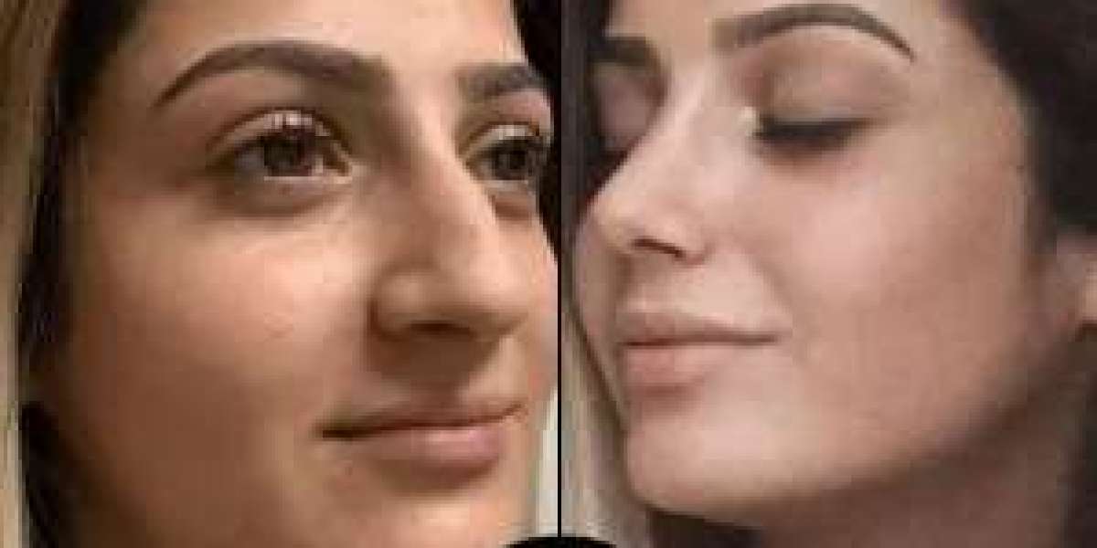 Best Plastic Surgeons in Dubai: Who Truly Transformed Me