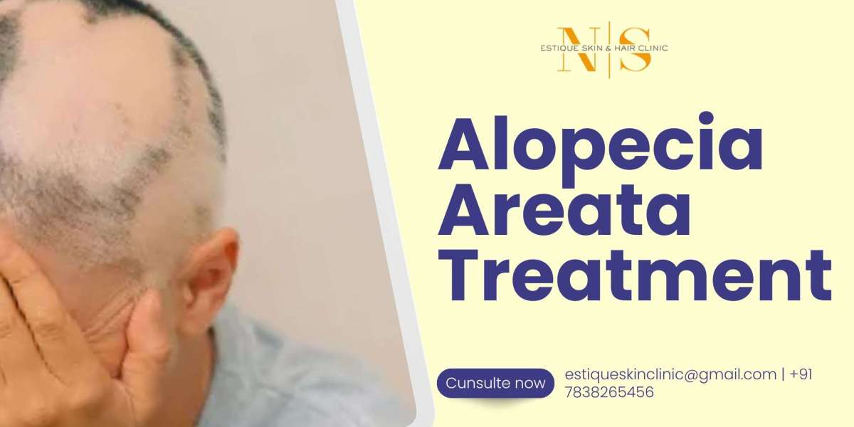 Early Signs of Alopecia Areata