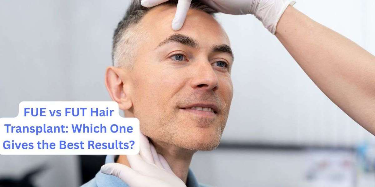 FUE vs FUT Hair Transplant: Which One Gives the Best Results?