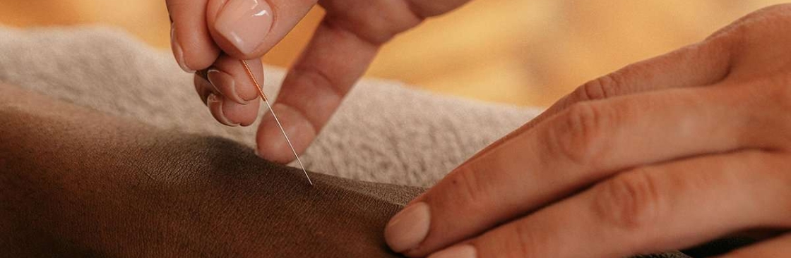 Evodia Acupuncture Cover Image