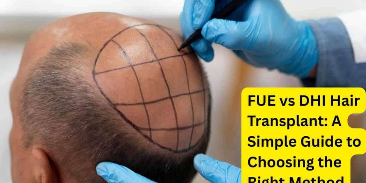 FUE vs DHI Hair Transplant: Which Method Works Best?