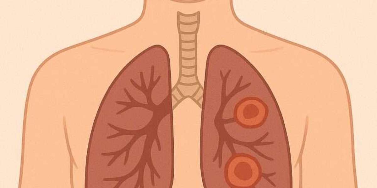 Finding the Right Asthma Doctor in Andheri West