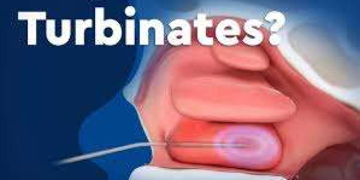 Top Benefits of Choosing Turbinate Reduction in Beverly Hills for Chronic Nasal Obstruction