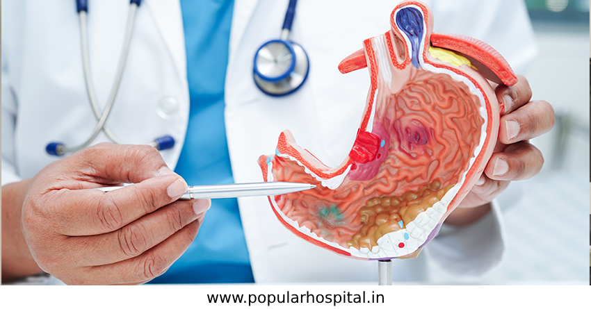 Top Gastroenterologist in Varanasi: Diagnosis, Diet Advice, Treatment & More