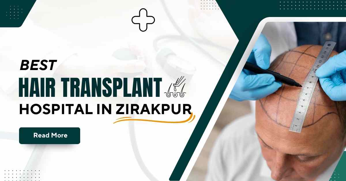Best Hair Transplant Hospital in Zirakpur | Mahendra Hair and Skin