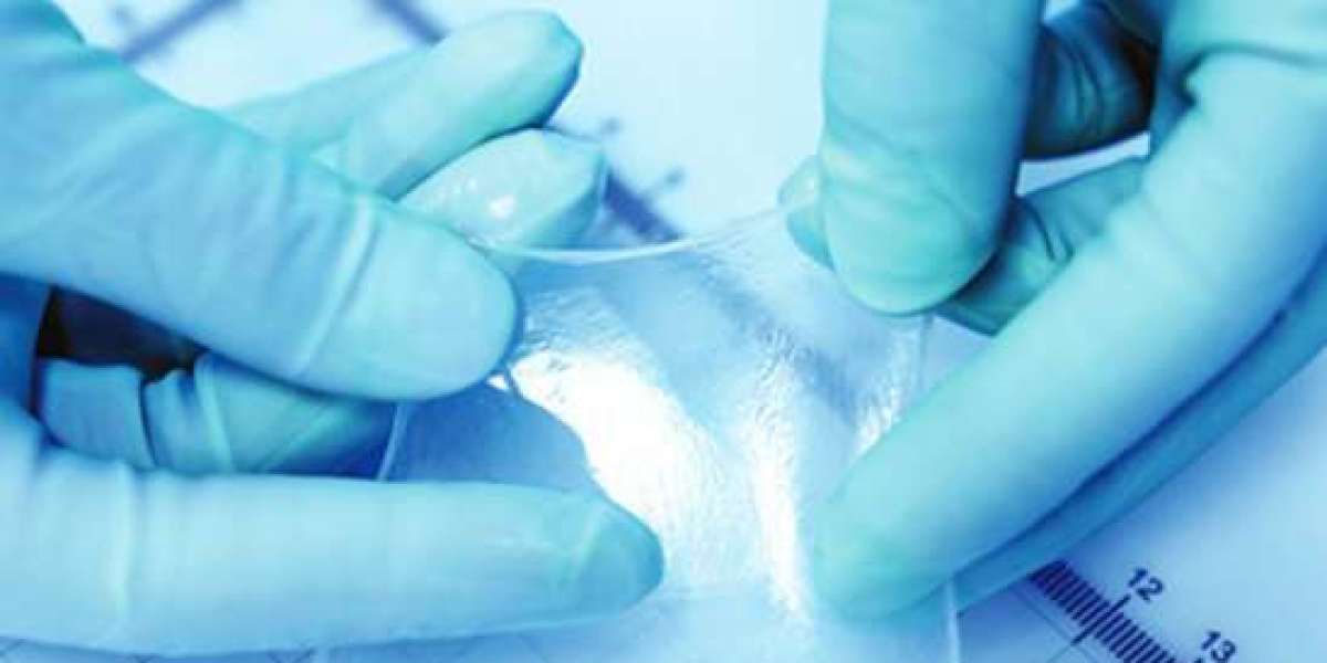 Regenerative Healing with Xcell Amnio Matrix for Advanced Wound Care