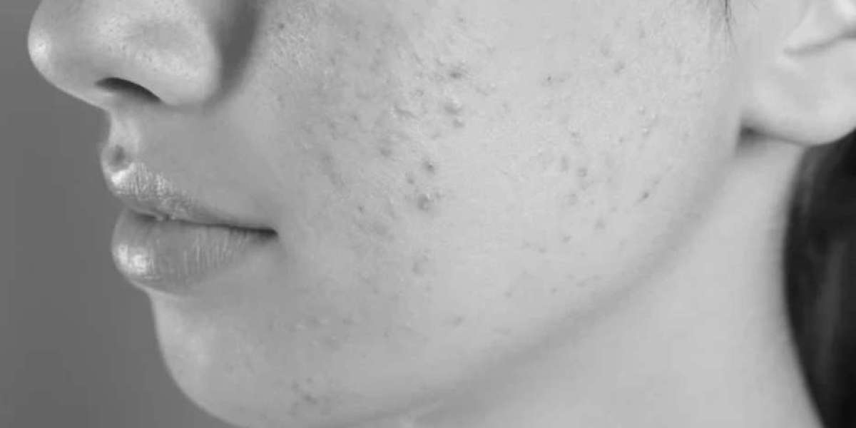 Anti Aging Products In India