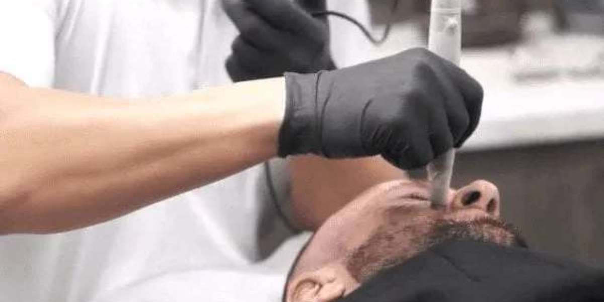 Hair Removal For Men in Paddington