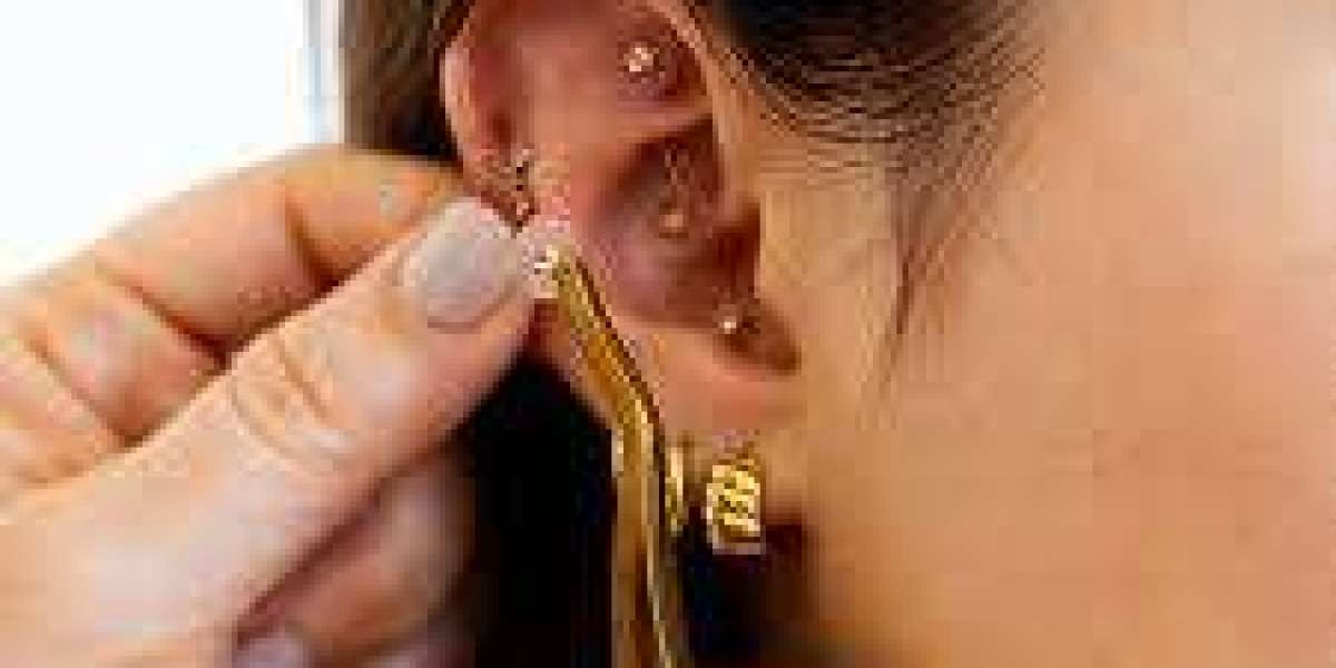 Ear Seeding Therapy: Small Points, Big Wellness Benefits