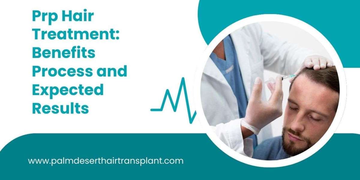 Prp Hair Treatment: Benefits, Process, and Expected Results