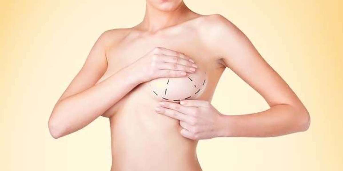 Breast Augmentation Surgery in Dubai with the Best Plastic Surgeon in Dubai – Dr. Anshu Plastic Surgeon