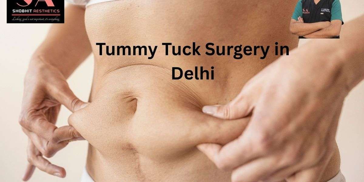 Tummy Tuck Surgery in Delhi: A Complete, Honest Guide