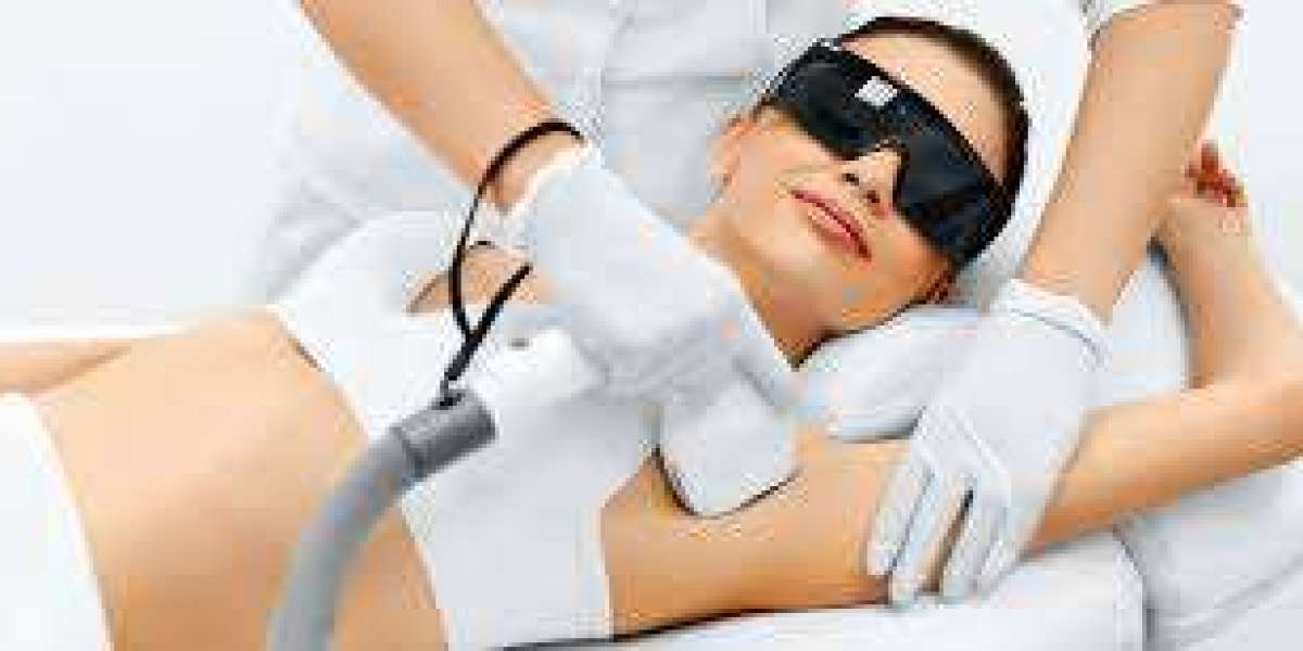 Laser Hair Removal Ottawa: Expert Guide to Safe, Effective Treatments