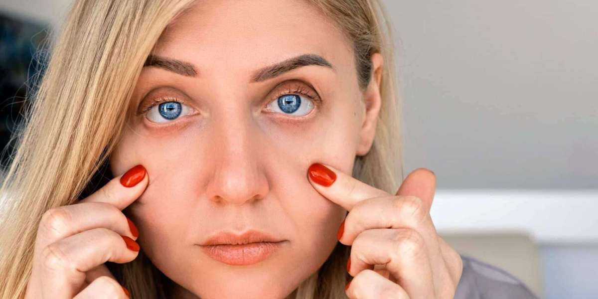 The Science Behind Dark Circles Causes and Treatments That Actually Work