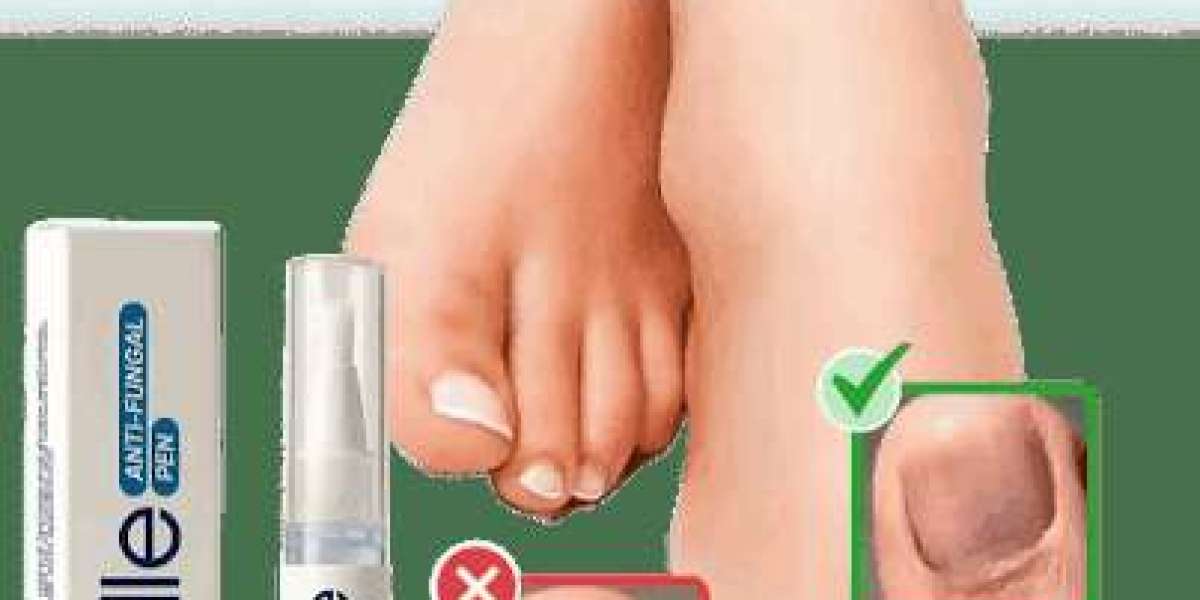 Orivelle Fungus Pen Reviews