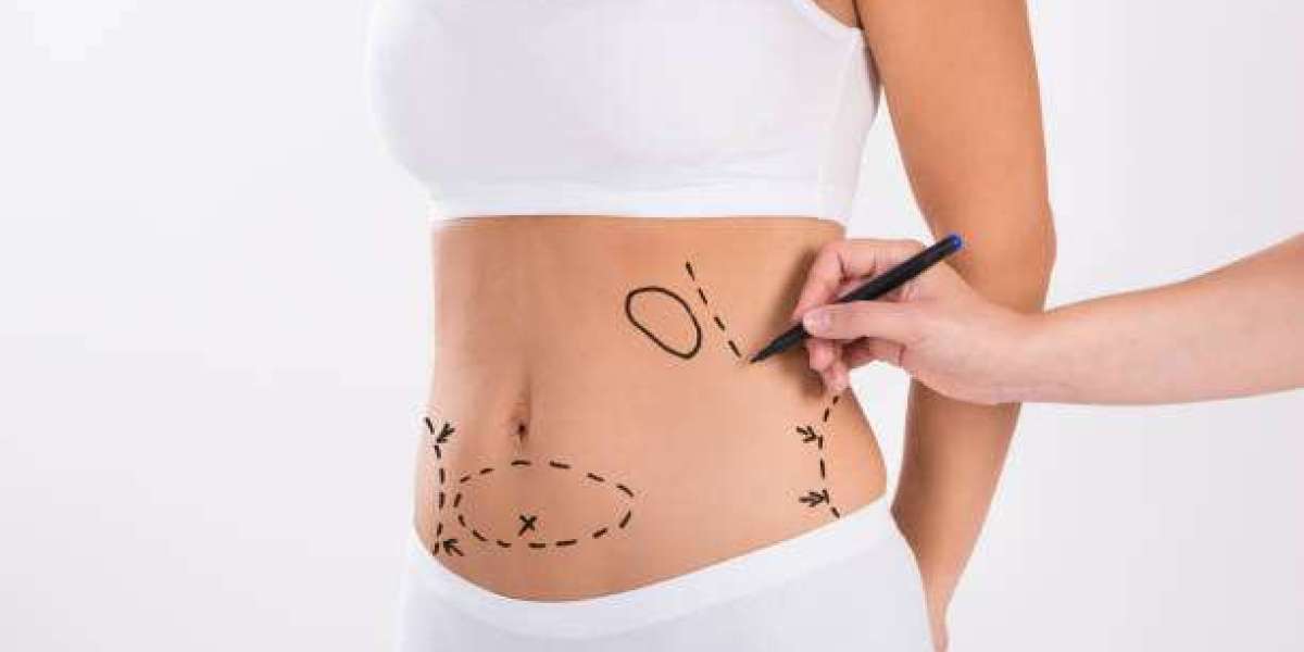 How Pinpoint Liposuction Procedure for Cellulite?