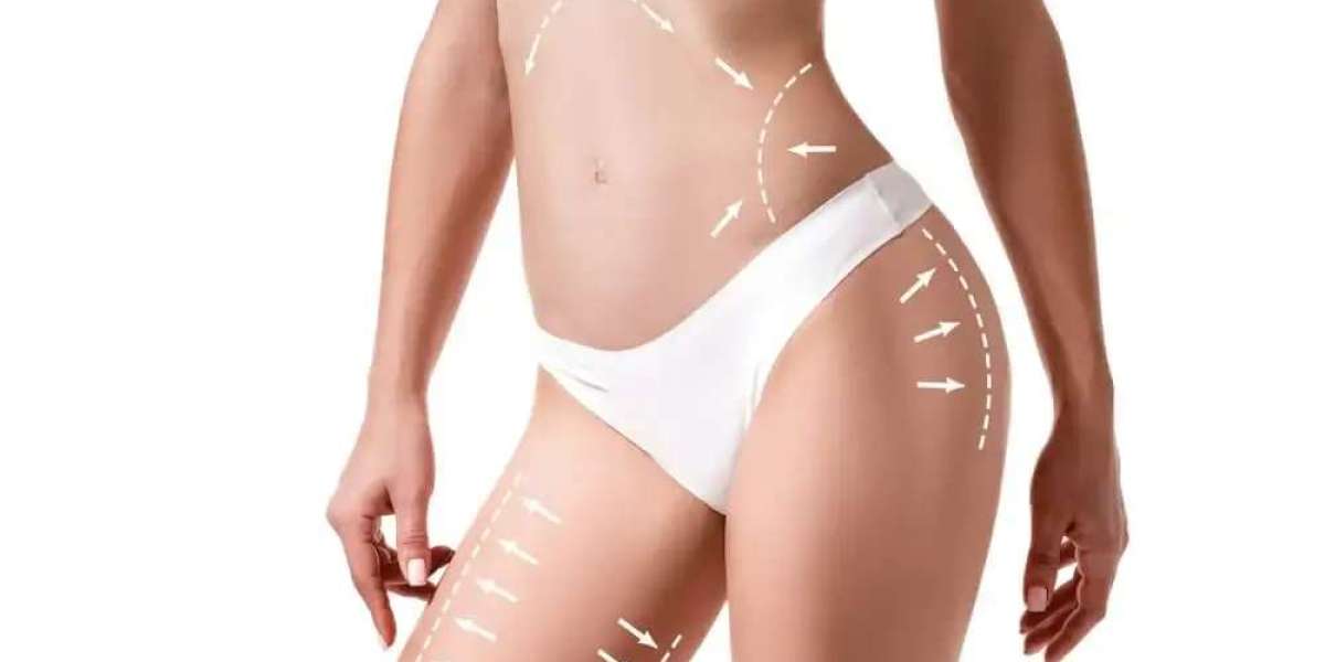 Liposuction 101: Everything First-Timers Need to Know