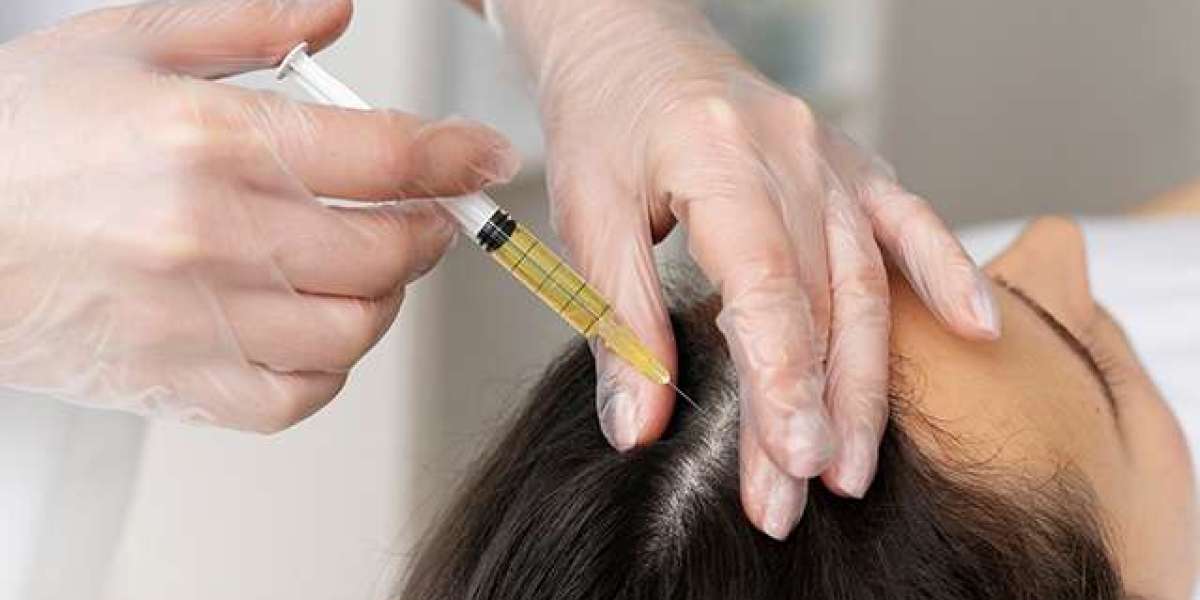 Why Exosomes Are Gaining Popularity in Hair Restoration Clinics