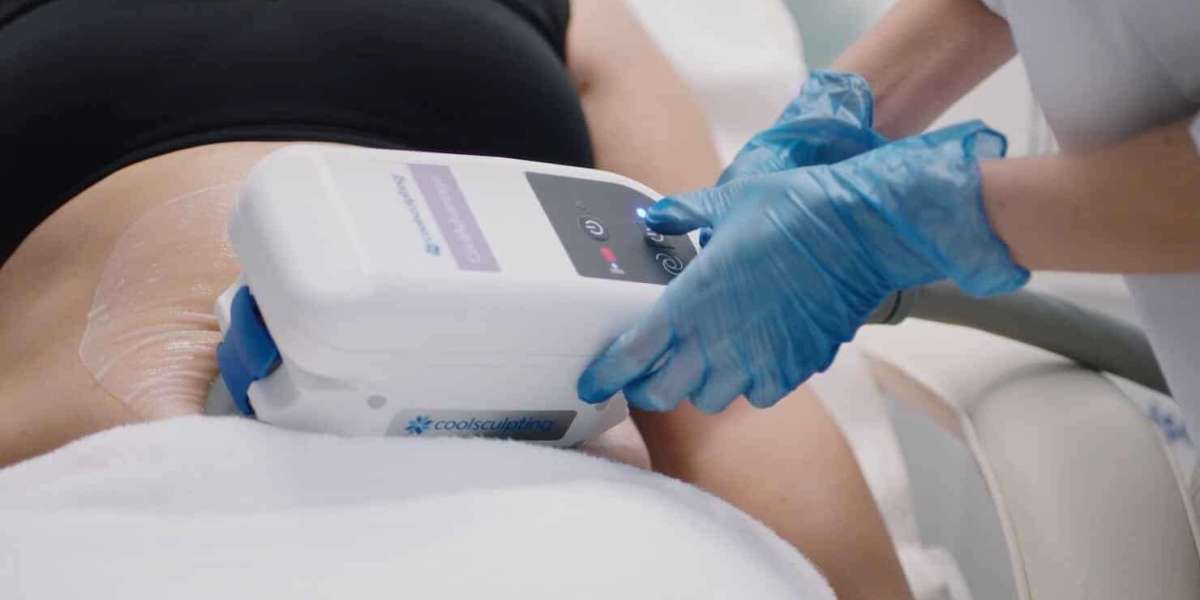 How to Prepare for Your CoolSculpting Appointment