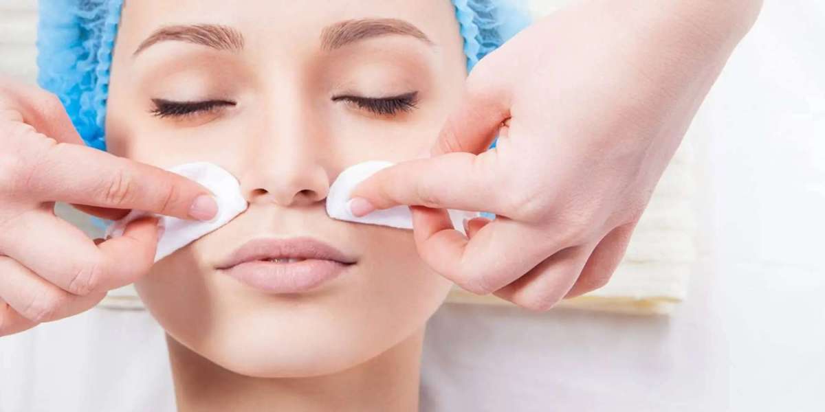 How Chemical Peels Help Improve Skin Texture