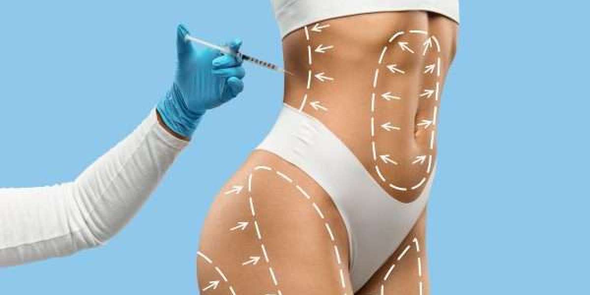 Fat Melting Injections for Women: Top Tips and Tricks