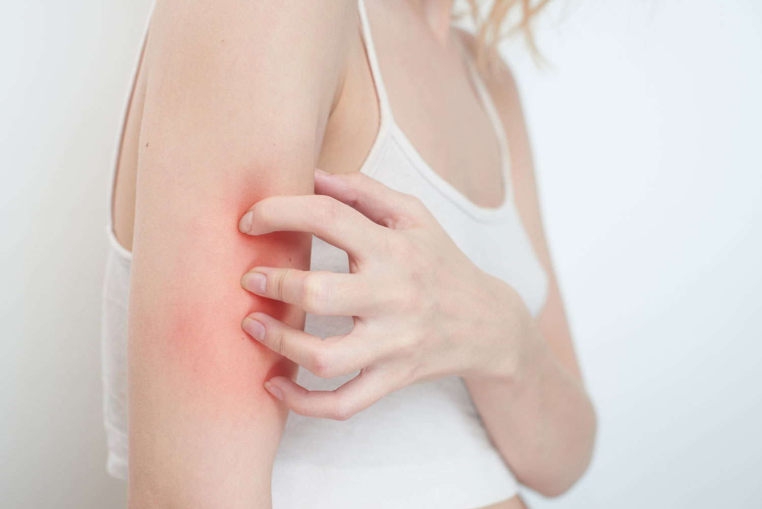 Itchy Skin Relief | Dermatology Associates