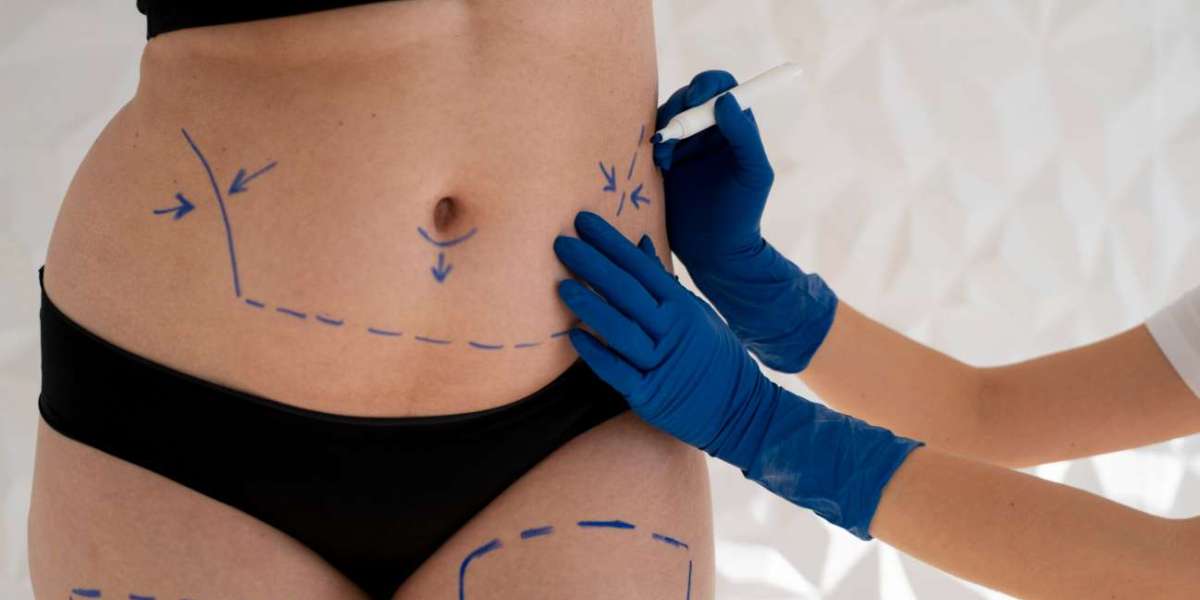 Why Tampa Palms Plastic Surgery Is a Trusted Choice for Cosmetic Procedures