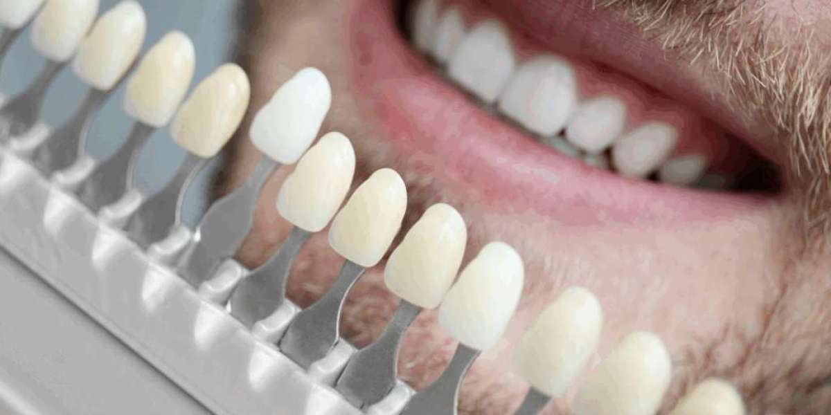 How Finding the Right Dentist Nambour Helped Me Finally Stay on Top of My Dental Health
