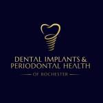 DENTAL IMPLANTS and PERIODONTAL HEALTH Profile Picture